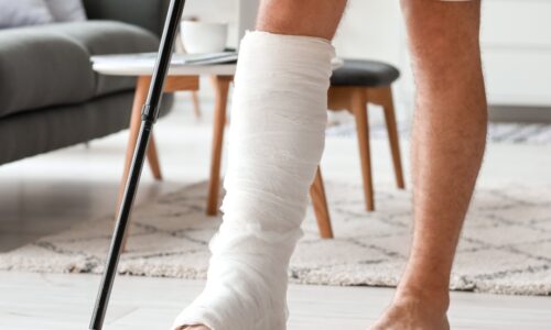 Fracture Injuries After a Car Accident